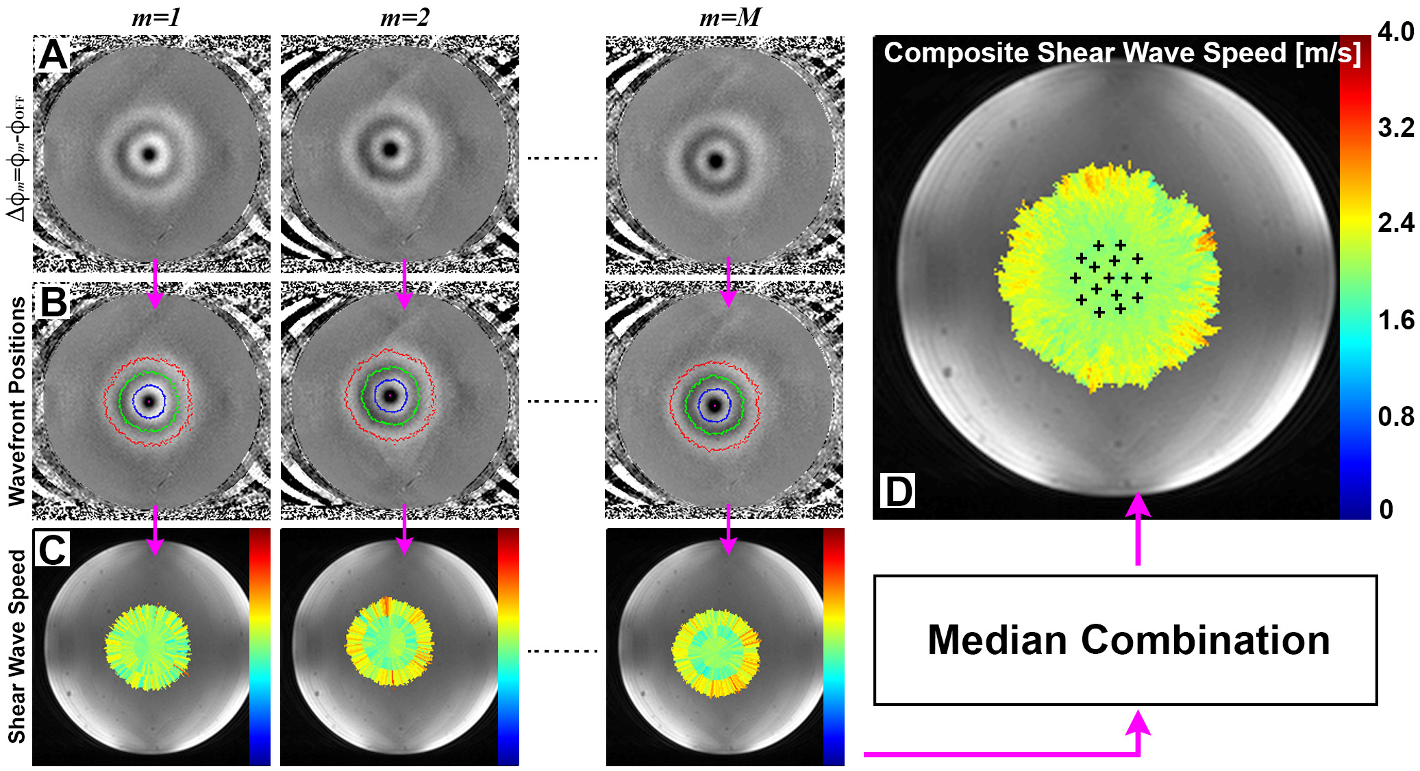 Shear Wave Speed Quantification